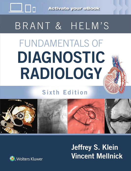 Brant & Helms' Fundamentals of Diagnostic Radiology 6th Edition Premium Multicolor Matte Print