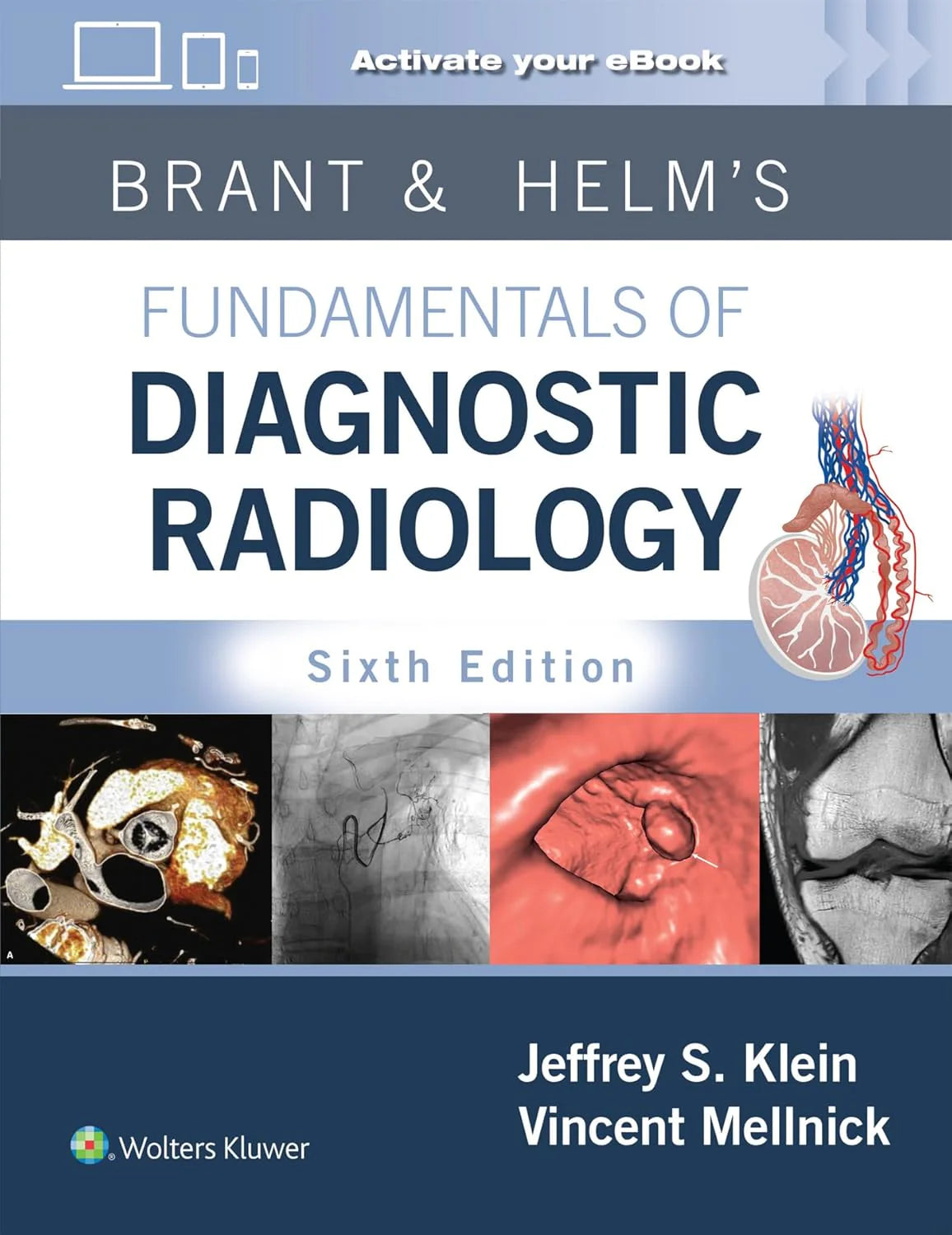 Brant & Helms' Fundamentals of Diagnostic Radiology 6th Edition Premium Multicolor Matte Print